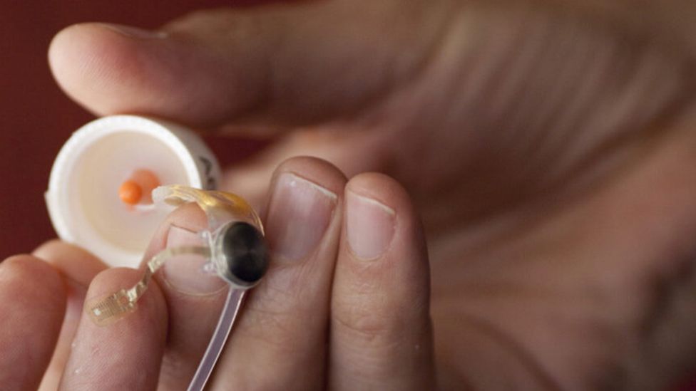 Bionic eyes: Obsolete tech leaves patients in the dark